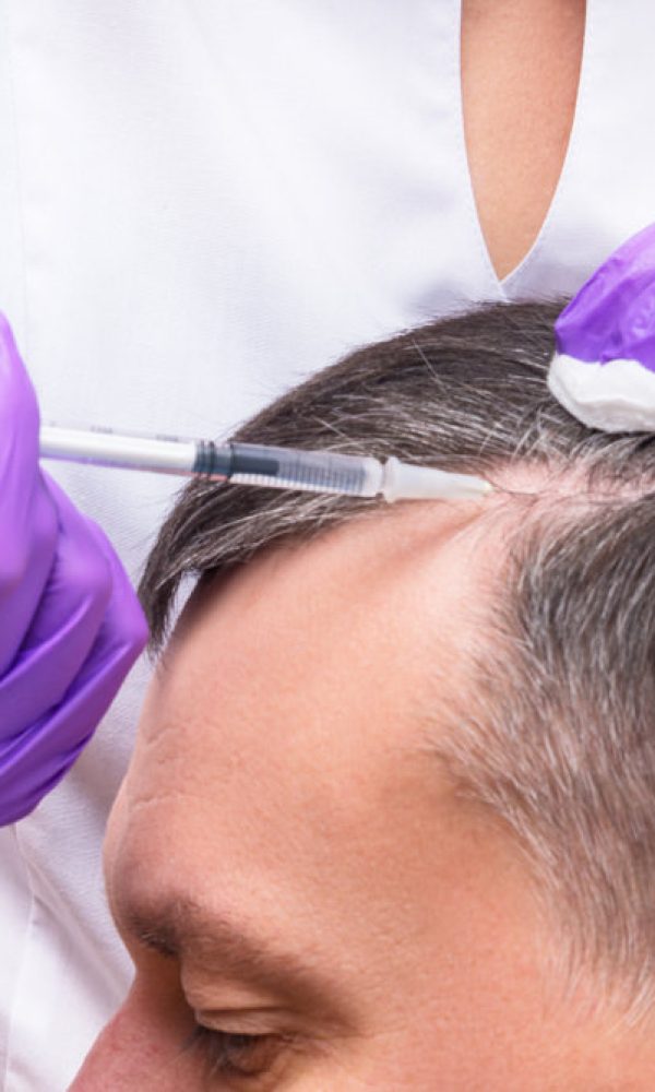 prp-treatment prp-treatment